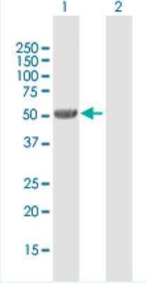 Western Blot: UGT2B7 Antibody [H00007364-B01P-50ug] - Analysis of UGT2B7 expression in transfected 293T cell line (H00007364-T01) by UGT2B7 MaxPab polyclonal antibody.  Lane 1: UGT2B7 transfected lysate(58.19 KDa). Lane 2: Non-transfected lysate.