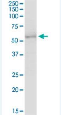 Western Blot UGT2B7 Antibody - Azide and BSA Free