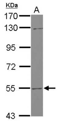 Western Blot: UGT2B7 Antibody [NBP2-15155] - Sample (30 ug of whole cell lysate) A: HepG2 7. 5% SDS PAGE; antibody diluted at 1:1000.