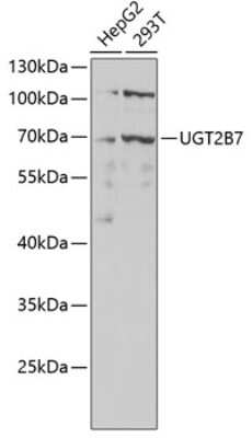 Western Blot UGT2B7 Antibody - Azide and BSA Free