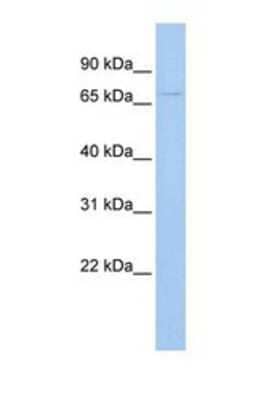 Western Blot: UGT3A2 Antibody [NBP1-69422] - This Anti-UGT3A2 antibody was used in Western Blot of 293T tissue lysate at a concentration of 1ug/ml.