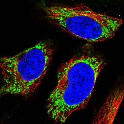 Immunocytochemistry/Immunofluorescence: UGT8 Antibody [NBP2-56391] - Staining of human cell line HeLa shows localization to mitochondria.