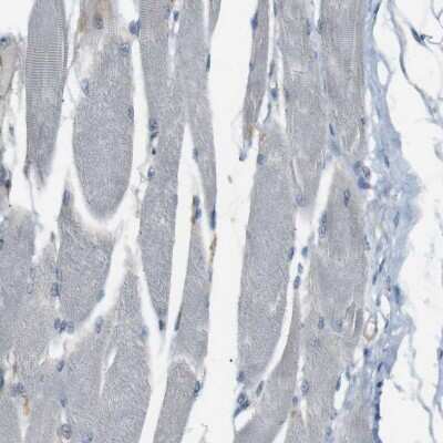 Immunohistochemistry-Paraffin: UGT8 Antibody [NBP1-84494] - Staining of human skeletal muscle shows no positivity in myocytes as expected.