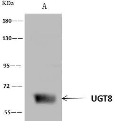 Immunoprecipitation: UGT8 Antibody [NBP3-12586] - Lane A:0.5 mg Mouse brain tissue Whole Cell Lysate4 uL anti-UGT8 rabbit polyclonal antibody and 60 ug of Immunomagnetic beads Protein A/G.Primary antibody:Anti-UGT8 rabbit polyclonal antibody,at 1:100 dilution Secondary antibody:Goat Anti-Rabbit IgG (H+L)/HRP at 1/10000 dilutionDeveloped using the ECL technique.Performed under reducing conditions.Predicted band size: 61 kDaObserved band size :61 kDa