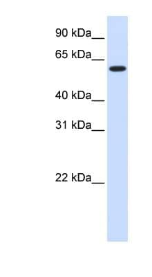 Western Blot: UGT8 Antibody [NBP1-62245] - Human Heart lysate, concentration 0.2-1 ug/ml.