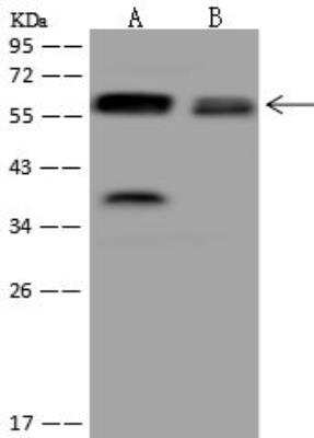 Western Blot: UGT8 Antibody [NBP3-12586] - Lane A: Mouse brain tissue lysateLane B: U-251 MG Whole Cell LysateLysates/proteins at 30 ug per lane.SecondaryGoat Anti-Rabbit IgG (H+L)/HRP at 1/10000 dilution.Developed using the ECL technique.Performed under reducing conditions.Predicted band size:61 kDaObserved band size:61 kDa(We are unsure as to the identity of these extra bands.)
