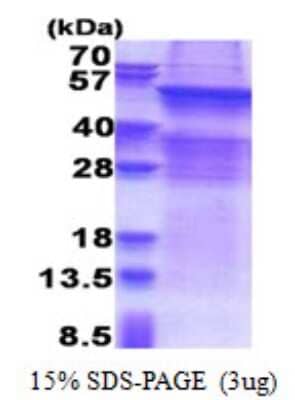 SDS-Page: UGT8 Protein [NBP2-22928]