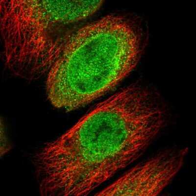 Immunocytochemistry/Immunofluorescence: ICBP90 Binding Protein 1 Antibody [NBP1-88255] - Immunofluorescent staining of human cell line A-431 shows localization to nucleoplasm, nuclear membrane & cytosol.