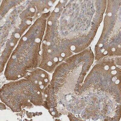 Immunohistochemistry: ICBP90 Binding Protein 1 Antibody [NBP1-88255] - Staining of human duodenum shows moderate cytoplasmic and membranous positivity in glandular cells.