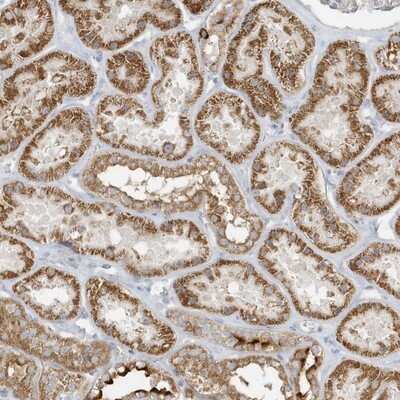 Immunohistochemistry-Paraffin: ICBP90 Binding Protein 1 Antibody [NBP1-88254] - Staining of human kidney shows moderate cytoplasmic positivity in tubule cells.