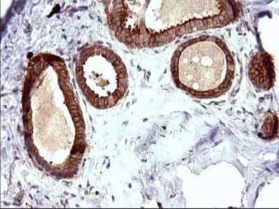 Immunohistochemistry-Paraffin: UIP1 Antibody (OTI1E8) [NBP2-45932] - Analysis of Human breast tissue. (Heat-induced epitope retrieval by 10mM citric buffer, pH6.0, 120C for 3min)