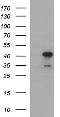 Western Blot: UIP1 Antibody (OTI1E8) [NBP2-45932] - Analysis of HEK293T cells were transfected with the pCMV6-ENTRY control (Left lane) or pCMV6-ENTRY UIP1.