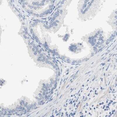 Immunohistochemistry-Paraffin: ULBP-1 Antibody [NBP1-80856] - Staining of human prostate shows low expression as expected.