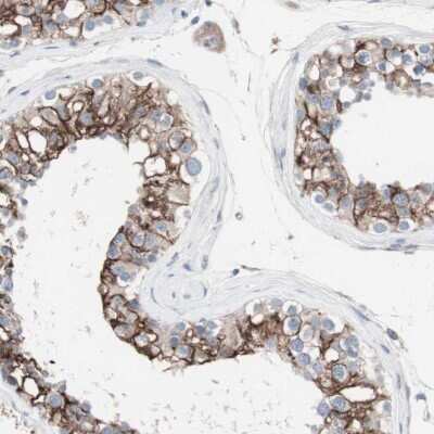 Immunohistochemistry-Paraffin: ULBP-1 Antibody [NBP1-80856] - Staining of human testis shows high expression.