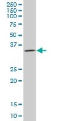 Western Blot: ULBP-2 Antibody [H00080328-B01P] - Analysis of ULBP2 expression in human ovarian cancer.