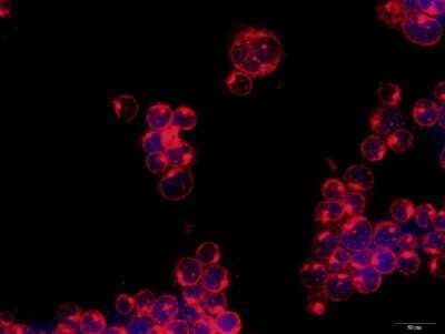 Immunocytochemistry/Immunofluorescence: ULBP-3 Antibody [NBP2-31866] - Staining  ULBP-3 in methanol-fixed, Jurkat cells using anti-ULBP-3 antibody. Image submitted by a verified customer review. 