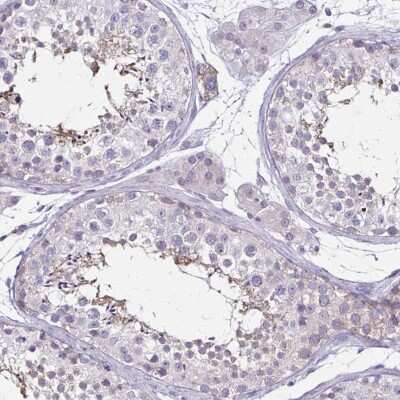 Immunohistochemistry-Paraffin: ULBP-3 Antibody [NBP2-31866] - Staining of human testis shows moderate positivity in a subset of cells in seminiferous ducts.