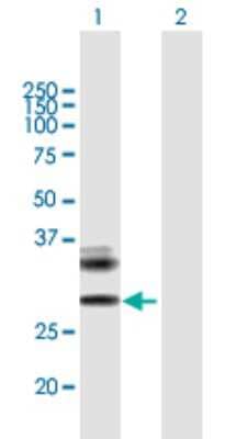 Western Blot: ULBP-4/RAET1E Antibody [H00135250-B01P] - Analysis of RAET1E expression in transfected 293T cell line by RAET1E polyclonal antibody.  Lane 1: RAET1E transfected lysate(28.93 KDa). Lane 2: Non-transfected lysate.