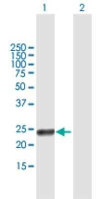 Western Blot ULBP-5/RAET1G Antibody - Azide and BSA Free