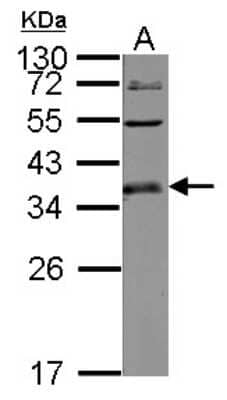 Western Blot: ULBP1 Antibody [NBP2-20808] - Sample (30 ug of whole cell lysate) A: K562 12% SDS PAGE gel, diluted at 1:2000.