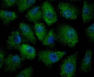 Immunocytochemistry/Immunofluorescence: ULK1 Antibody [NBP2-80424] - Staining ULK1 in A549 cells (green). The nuclear counter stain is DAPI (blue). Cells were fixed in paraformaldehyde, permeabilized with 0.25% Triton X100/PBS.