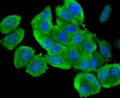 Immunocytochemistry/Immunofluorescence: ULK1 Antibody [NBP2-80424] - Staining ULK1 in MCF-7 cells (green). The nuclear counter stain is DAPI (blue). Cells were fixed in paraformaldehyde, permeabilized with 0.25% Triton X100/PBS.