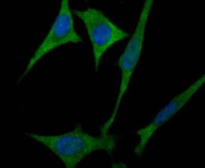 Immunocytochemistry/Immunofluorescence: ULK1 Antibody [NBP2-80424] - Staining ULK1 in SH-SY5Y cells (green). The nuclear counter stain is DAPI (blue). Cells were fixed in paraformaldehyde, permeabilized with 0.25% Triton X100/PBS.