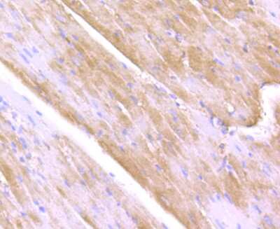 Immunohistochemistry-Paraffin: ULK1 Antibody [NBP2-80424] - Analysis in rat heart tissue using ULK1 antibody. Counter stained with hematoxylin.