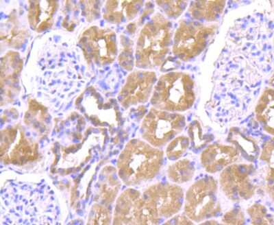 Immunohistochemistry-Paraffin: ULK1 Antibody [NBP2-80424] - Analysis in human kidney tissue using ULK1 antibody. Counter stained with hematoxylin.