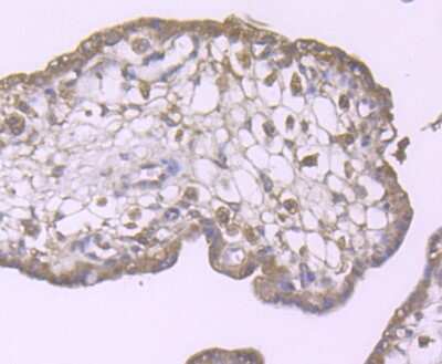 Immunohistochemistry-Paraffin: ULK1 Antibody [NBP2-80424] - Analysis in human placenta tissue using ULK1 antibody. Counter stained with hematoxylin.