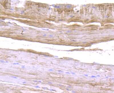 Immunohistochemistry-Paraffin: ULK1 Antibody [NBP2-80424] - Analysis in mouse skeletal muscle tissue using ULK1 antibody. Counter stained with hematoxylin.