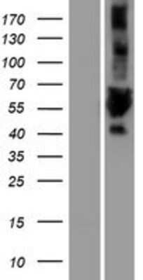 Western Blot: ULK3 Overexpression Lysate (Adult Normal) [NBP2-08281] Left-Empty vector transfected control cell lysate (HEK293 cell lysate); Right -Over-expression Lysate for ULK3.