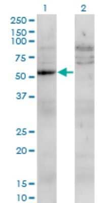 Western Blot: UMPS Antibody (2F5) [H00007372-M05] - Analysis of UMPS expression in transfected 293T cell line by UMPS monoclonal antibody (M05), clone 2F5. Lane 1: UMPS transfected lysatE (52.2 KDa). Lane 2: Non-transfected lysate.