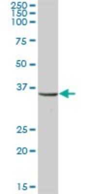 Western Blot: UMPS Antibody [H00007372-B01P] - Analysis of UMPS expression in human placenta.