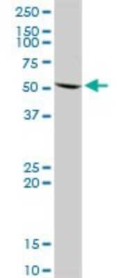 Western Blot: UMPS Antibody [H00007372-D01P] - Analysis of UMPS expression in HeLa.