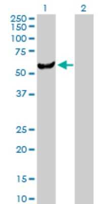 Western Blot: UMPS Antibody [H00007372-D01P] - Analysis of UMPS expression in transfected 293T cell line by UMPS polyclonal antibody.Lane 1: UMPS transfected lysate(52.20 KDa).Lane 2: Non-transfected lysate.