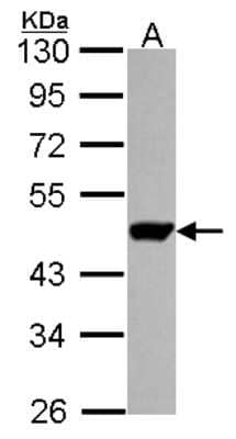 Western Blot UMPS Antibody