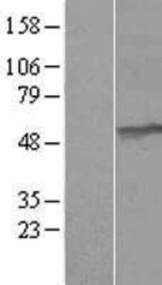 Western Blot UMPS Overexpression Lysate