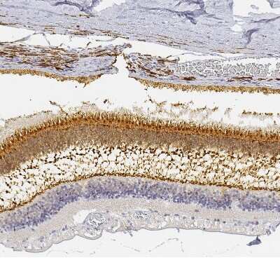Immunohistochemistry-Paraffin: UNC119 Antibody [NBP1-81708] - Staining of human retina shows moderate cytoplasmic positivity in photoreceptor cells and outer plexiform layer.