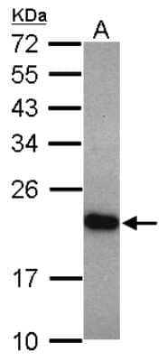 Western Blot: UNC119 Antibody [NBP2-20811] - Sample (30 ug of whole cell lysate) A: HeLa 12% SDS PAGE gel, diluted at 1:1000.