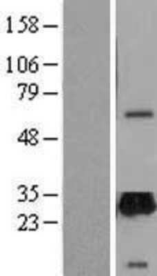Western Blot UNC119 Overexpression Lysate