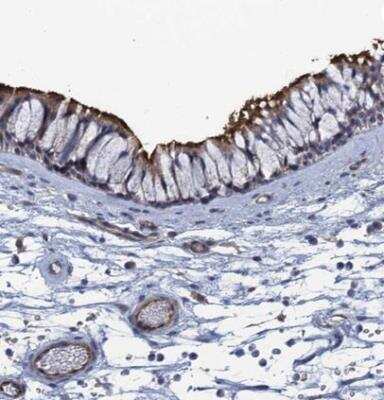 Immunohistochemistry-Paraffin: UNC13A/Munc13-1 Antibody [NBP1-87895] - Staining of human nasopharynx shows distinct membranous positivity in respiratory epithelial cells.