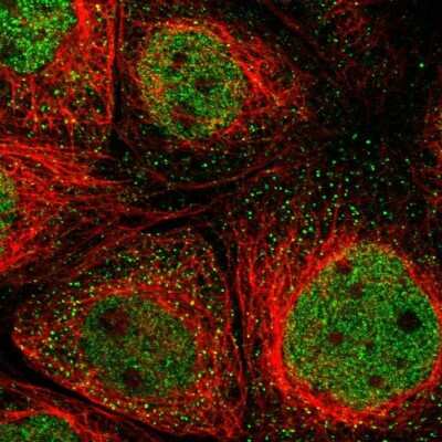 Immunocytochemistry/Immunofluorescence: UNC13B Antibody [NBP1-83244] - Staining of human cell line A-431 shows localization to nucleoplasm & vesicles.