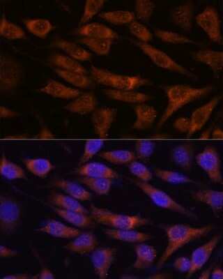 Immunocytochemistry/Immunofluorescence: UNC13B Antibody [NBP2-93337] - Analysis of L929 cells using UNC13B at dilution of 1:100. Blue: DAPI for nuclear staining.