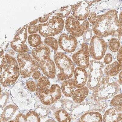 Immunohistochemistry: UNC13B Antibody [NBP1-83244] - Staining of human kidney shows moderate cytoplasmic positivity in tubule cells.