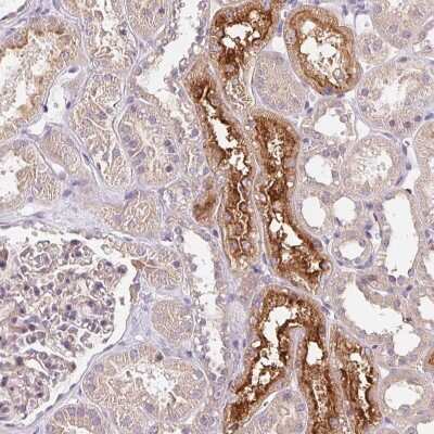 Immunohistochemistry: UNC13B Antibody [NBP2-49364] - Staining of human kidney shows strong cytoplasmic and membranous positivity in renal tubules.