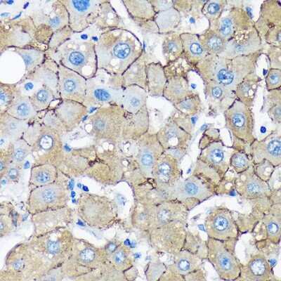 Immunohistochemistry-Paraffin: UNC13B Antibody [NBP2-93337] - Immunohistochemistry of paraffin-embedded Human liver using UNC13B Rabbit pAb (NBP2-93337) at dilution of 1:100 (40x lens). Perform microwave antigen retrieval with 10 mM PBS buffer pH 7.2 before commencing with IHC staining protocol.