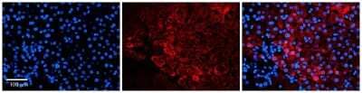 Immunohistochemistry: UNC45A Antibody [NBP1-54882] - Formalin Fixed Paraffin Embedded Tissue: Human Liver Tissue Observed Staining: Cytoplasm in hepatocytes Primary Antibody Concentration: 1:100 Other Working Concentrations: N/A Secondary Antibody: Donkey anti-Rabbit-Cy3 Secondary Antibody Concentration: 1:200 Magnification: 20X Exposure Time: 0.5 - 2.0 sec