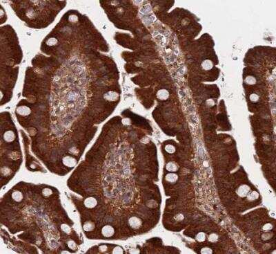 Immunohistochemistry-Paraffin UNC45A Antibody - BSA Free