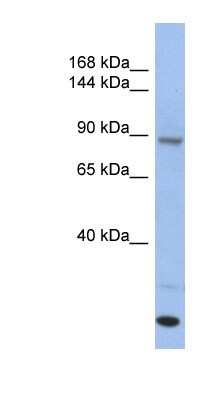 Western Blot: UNC45A Antibody [NBP1-54882] - Human Thymus lysate, concentration 0.2-1 ug/ml.